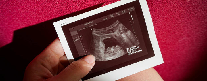 11. Schwangerschaftswoche (11. SSW) – das Gesicht deines Babys ist erkennbar