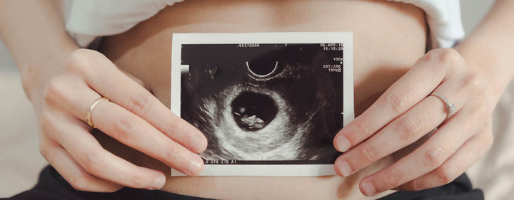 8. Schwangerschaftswoche (8. SSW) – die Sinnesorgane deines Babys verknüpfen sich mit dem Gehirn