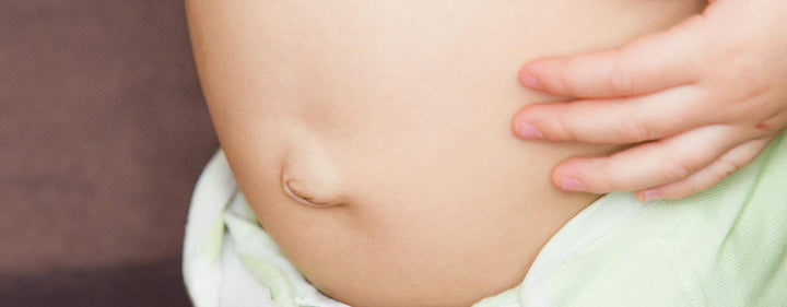 Nabelbruch beim Baby: Aussehen, Ursachen & Behandlung